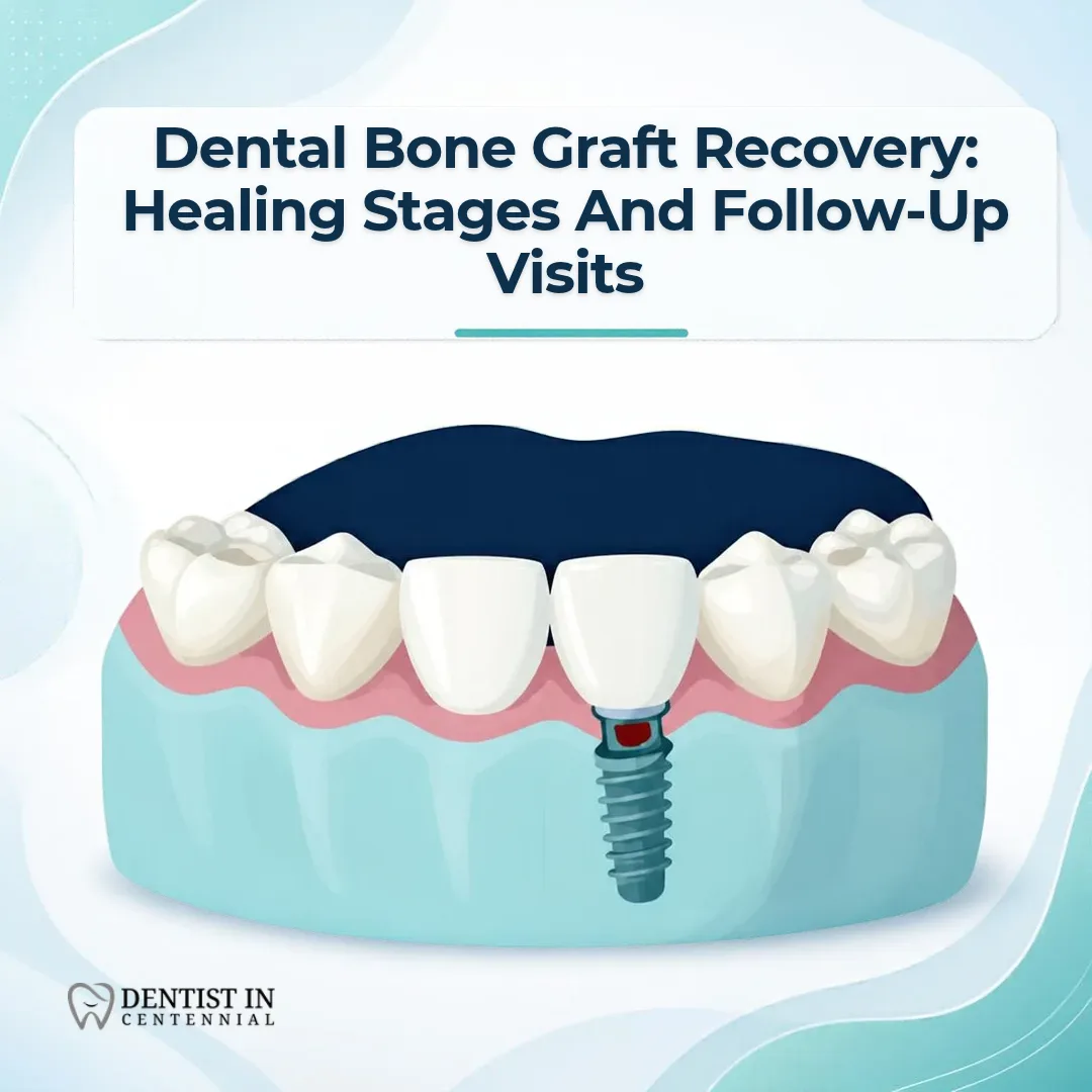 Dental Bone Graft Recovery: Healing Stages and Follow-Up Visits