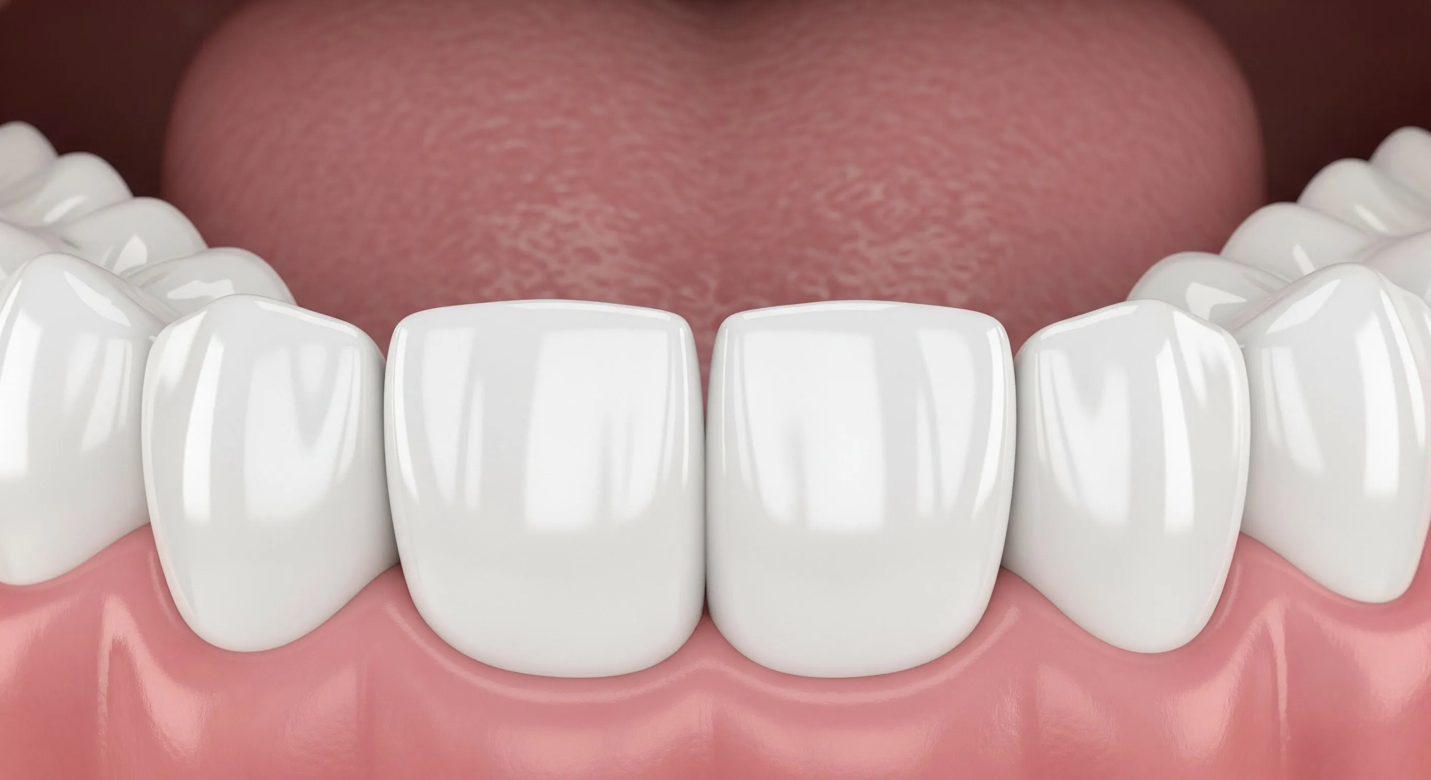 Dental Fillings Patient
