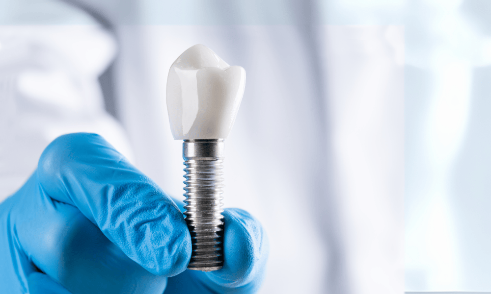 Why Choose Dentist in Centennial for Dental Implants?